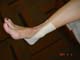 Ankle Taping